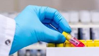 Muzaffarpur and Patna are the two locations in India where the Drugs for Neglected Diseases initiative (DNDi), a Geneva-based organisation, has chosen to conduct the phase II trials for new kala-azar drug. (Bloomberg) Muzaffarpur and Patna are the two locations in India where the Drugs for Neglected Diseases initiative (DNDi), a Geneva-based organisation, has chosen to conduct the phase II trials for new kala-azar drug. (Bloomberg)