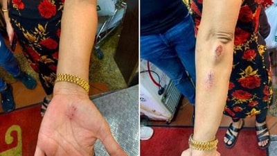 Madam Hindocha Nita Vishnubhai was assaulted while brisk walking from Choa Chu Kang MRT station towards Choa Chu Kang stadium. (The Straits Times) Madam Hindocha Nita Vishnubhai was assaulted while brisk walking from Choa Chu Kang MRT station towards Choa Chu Kang stadium. (The Straits Times)