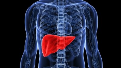 Women consuming sugar-sweetened drinks daily are a higher risk of developing liver cancer and chronic liver disease mortality. (Twitter/AHealthyBod) Women consuming sugar-sweetened drinks daily are a higher risk of developing liver cancer and chronic liver disease mortality. (Twitter/AHealthyBod)