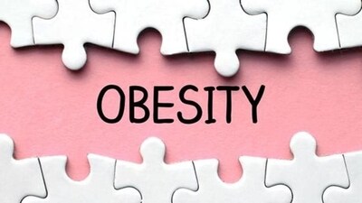 Overweight people’s brains have different appetite control centre: Study (Shutterstock Image) Overweight people’s brains have different appetite control centre: Study (Shutterstock Image)