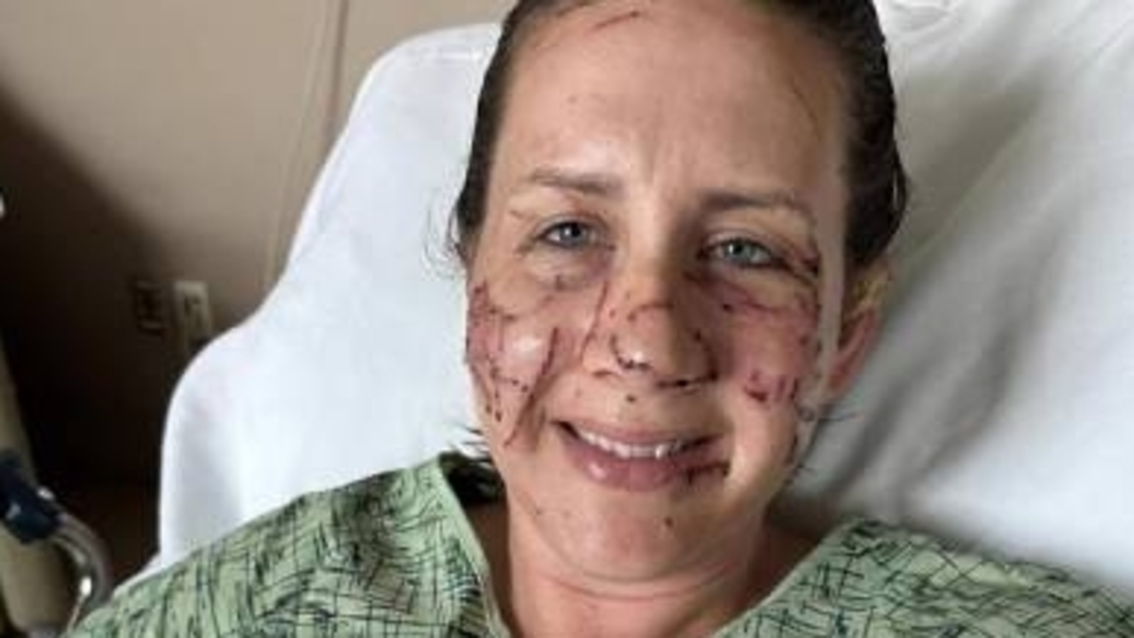 Montana woman recalls 'life-threatening' attack by an otter in Jefferson River | Trending - Vimarsana News