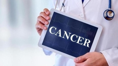 Here's how proteins drive growth of multiple cancer types, reveals study (Shutterstock)