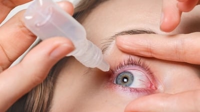 Chandra also said that when an individual's Conjunctivitis is caused by a viral source and they commence using steroid-containing eye drops, they inadvertently introduce a risk of potentially extending the duration of the infection.&nbsp; (Freepik)