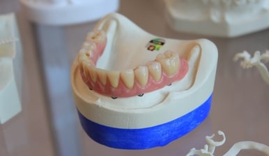 Bite Rehabilitation: All you need to know about this dental procedure for jaw problems (Photo by Quang Tri NGUYEN on Unsplash) Bite Rehabilitation: All you need to know about this dental procedure for jaw problems (Photo by Quang Tri NGUYEN on Unsplash)