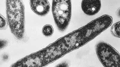 Legionnaire's outbreak: This 1978 electron microscope image made available by the Centers for Disease Control and Prevention shows Legionella pneumophila bacteria. (AP) Legionnaire's outbreak: This 1978 electron microscope image made available by the Centers for Disease Control and Prevention shows Legionella pneumophila bacteria. (AP)