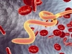 The case has marked the first such infection but more cases may arise in future, an expert said. The case has marked the first such infection but more cases may arise in future, an expert said.