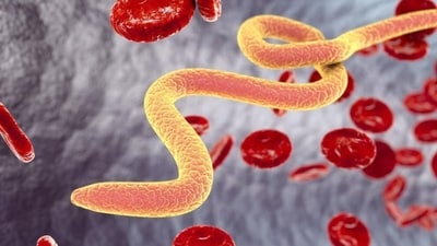 The case has marked the first such infection but more cases may arise in future, an expert said. (Representative image) The case has marked the first such infection but more cases may arise in future, an expert said. (Representative image)