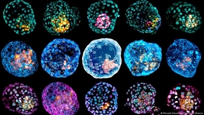 Cellular life first evolved around 3.7 billion years ago. What came first were loose arrangements of organic molecules in a bag-like vesicle, similar to the image here. (DW/Monash University/AP/picture alliance) Cellular life first evolved around 3.7 billion years ago. What came first were loose arrangements of organic molecules in a bag-like vesicle, similar to the image here. (DW/Monash University/AP/picture alliance)
