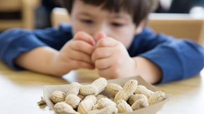 Common origin behind major childhood allergies: Study (Unsplash) Common origin behind major childhood allergies: Study (Unsplash)
