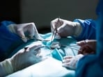 Bariatric surgery or weight loss surgery is a surgical procedure done on the stomach or intestines that help obese patients shed excess weight. Bariatric surgery or weight loss surgery is a surgical procedure done on the stomach or intestines that help obese patients shed excess weight.