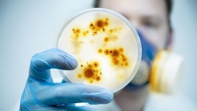 The researchers shed light on the immune cells' capacity to collectively migrate through diverse environments in their work. (Shutterstock) The researchers shed light on the immune cells' capacity to collectively migrate through diverse environments in their work. (Shutterstock)