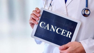 New genes that cause head, neck cancer patients to be resistant to chemotherapy: Study (Shutterstock) New genes that cause head, neck cancer patients to be resistant to chemotherapy: Study (Shutterstock)