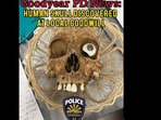Picture of the human skull found in the donation box. 