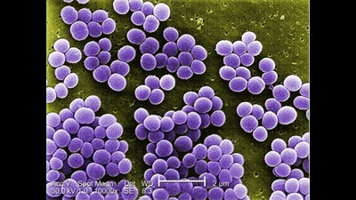 Staphylococcus aureus (For representation only) (HT Photo)