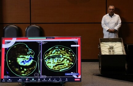 Remains of an allegedly 'non-human' being is seen on display during a briefing on unidentified flying objects, known as UFOs, at the San Lazaro legislative palace, in Mexico City, Mexico September 12, 2023. REUTERS/Henry Romero (REUTERS)