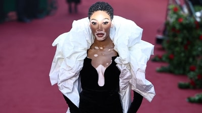 Canadian model Winnie Harlow poses upon arrival to attend the "Vogue World: London" event at the Theatre Royal Drury Lane in central London on the eve of London Fashion Week. (Photo by HENRY NICHOLLS / AFP) Canadian model Winnie Harlow poses upon arrival to attend the "Vogue World: London" event at the Theatre Royal Drury Lane in central London on the eve of London Fashion Week. (Photo by HENRY NICHOLLS / AFP)