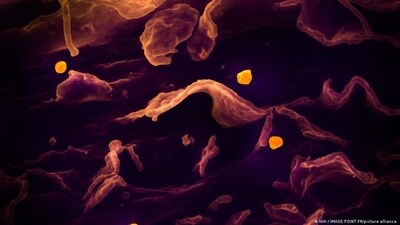 In this photo from a scanning electron microscope, the Nipah virus (colored yellow) can be seen budding from the surface of a cell. (DW/NIH / IMAGE POINT FR/picture alliance) In this photo from a scanning electron microscope, the Nipah virus (colored yellow) can be seen budding from the surface of a cell. (DW/NIH / IMAGE POINT FR/picture alliance)