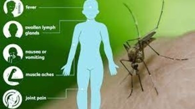 Data states that roughly one in five people infected with the virus develop symptoms. Data states that roughly one in five people infected with the virus develop symptoms.