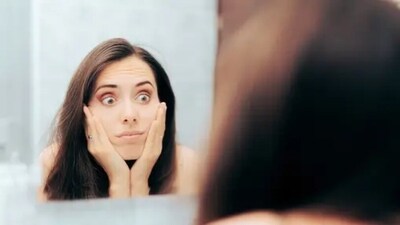 They try to avoid social situations as they think that people will perceive them as ugly.&nbsp; (Unsplash)