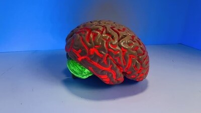 The team saw evidence that after undergoing CBT, patients experienced changes in the activities of all three networks that suggested a diminished focus on pain. (Unsplash) The team saw evidence that after undergoing CBT, patients experienced changes in the activities of all three networks that suggested a diminished focus on pain. (Unsplash)