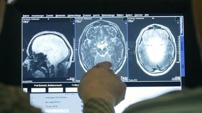 Researchers have been looking for medical treatments for Alzheimer's for decades, but their successes have been limited. (Jens Wolf/dpa/picture-alliance) Researchers have been looking for medical treatments for Alzheimer's for decades, but their successes have been limited. (Jens Wolf/dpa/picture-alliance)