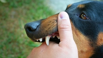 It is very important to immediately take vaccination after potential exposure to prevent rabies as once the symptoms start showing, it turns fatal, (Freepik) It is very important to immediately take vaccination after potential exposure to prevent rabies as once the symptoms start showing, it turns fatal, (Freepik)