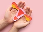 An estimated 70% of women with PCOS remain undiagnosed, worldwide