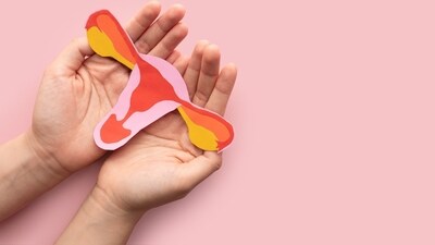 An estimated 70% of women with PCOS remain undiagnosed, worldwide (Shutterstock)
