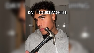 Breaking your bones can cause severe damage, pain, and deformity. (TikTok) Breaking your bones can cause severe damage, pain, and deformity. (TikTok)