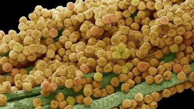 Pollen is a common cause of allergies. Scientists believe inverse vaccines could be used to treat them. (Science Photo Library/IMAGO ) Pollen is a common cause of allergies. Scientists believe inverse vaccines could be used to treat them. (Science Photo Library/IMAGO )