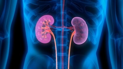 Some kidney patients may benefit most from quick dialysis: Study (Twitter/AshfordIns) Some kidney patients may benefit most from quick dialysis: Study (Twitter/AshfordIns)