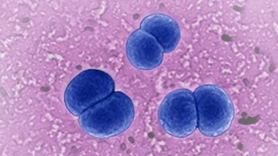 Under recognised contribution of viral pathogens to sepsis: Research (CAVALLINI JAMES/BSIP/picture alliance) Under recognised contribution of viral pathogens to sepsis: Research (CAVALLINI JAMES/BSIP/picture alliance)