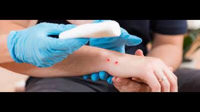 3 Uttar Pradesh districts selected for pilot project on snake-bite awareness (File photo)