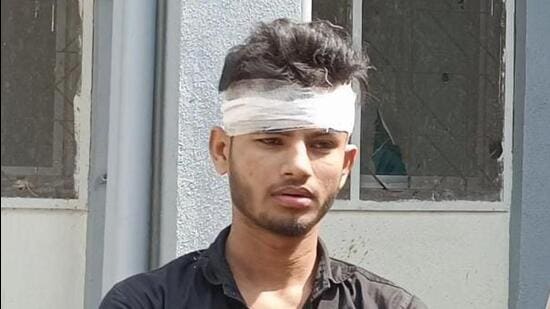 The two brothers were identified as Riaz Noor Mohammed, 19 and Farid Ansari, 22. They were rushed to Rukminibai Hospital where Farid was declared dead, while Riyaz was treated for injuries and discharged (HT PHOTO)
