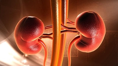 Kidney-friendly diet to lower your creatinine levels, promote overall kidney health (Shutterstock) Kidney-friendly diet to lower your creatinine levels, promote overall kidney health (Shutterstock)