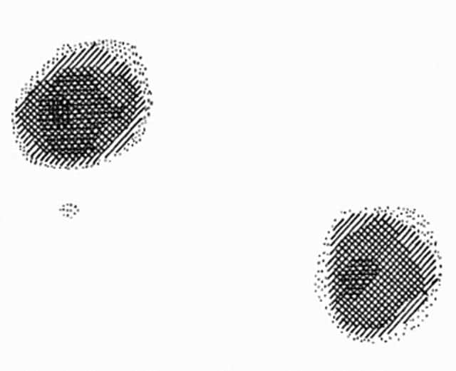The image of two test tubes of regular water immersed in heavy water, as presented in Paul Lauterbur’s seminal 1973 paper.