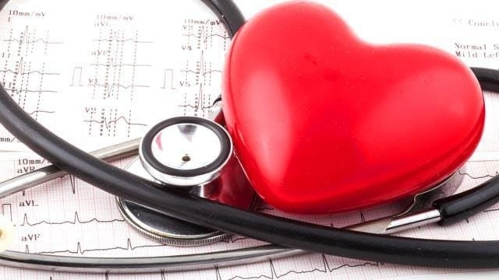 New heart rhythm categorisation for stroke patients: Study - Vimarsana News