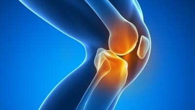 Runner’s Knee: Experts on warning signs to look out for Chondromalacia Patella (Shutterstock) Runner’s Knee: Experts on warning signs to look out for Chondromalacia Patella (Shutterstock)