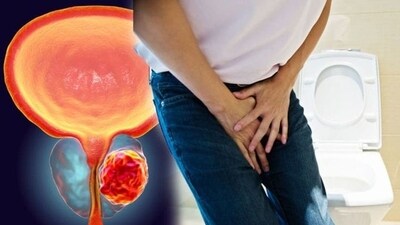 6 things to know about prostate cancer (Photo by Twitter/gyn_doctor) 6 things to know about prostate cancer (Photo by Twitter/gyn_doctor)
