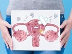 Ovarian cancer: Recognise the silent threat by watching out for these 5 symptoms Ovarian cancer: Recognise the silent threat by watching out for these 5 symptoms