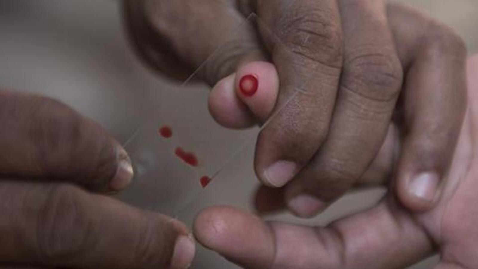 Platelet shortage at Pune hospitals amid surge in dengue cases - Vimarsana News