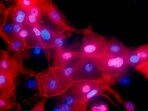 How innovative antibody approach targets deep-rooted cancer mutations: Study