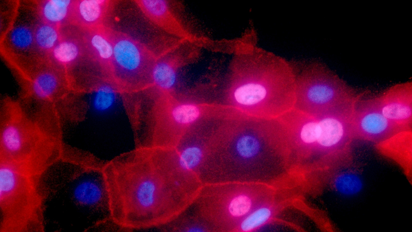 How innovative antibody approach targets deep-rooted cancer mutations: Study - Vimarsana News