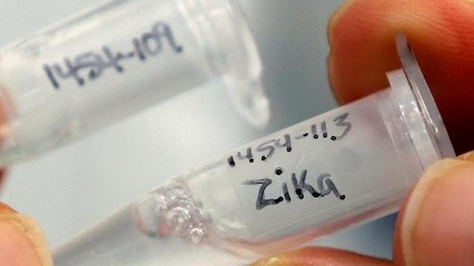 'Don't panic': Karnataka Health dept issues advisory after Zika virus discovery | Bengaluru - Vimarsana News