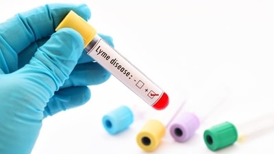 New insight into new antibiotic approach against lyme bacterium: Study (Shutterstock) New insight into new antibiotic approach against lyme bacterium: Study (Shutterstock)