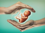 Does IVF have control over the gender of the child? Does IVF have control over the gender of the child?
