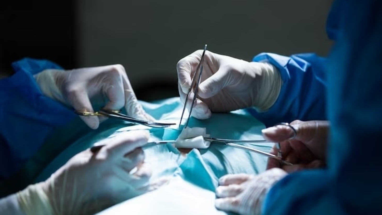 Delhi: AIIMS doctors extract needle from 7-year-old's lung using magnet - Vimarsana News