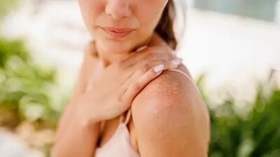 With the winter season setting in, problems of dry skin are about to appear. It is important to keep the skin moisturised and nourished to avoid irritation and dry patches on the skin. "Secrets of healing dry skin, beyond diet and lifestyle changes. Let's discover the natural remedies that can work wonders for dry skin," wrote Nutritionist Anjali Mukerjee as she shared a few tips. (Unsplash) With the winter season setting in, problems of dry skin are about to appear. It is important to keep the skin moisturised and nourished to avoid irritation and dry patches on the skin. "Secrets of healing dry skin, beyond diet and lifestyle changes. Let's discover the natural remedies that can work wonders for dry skin," wrote Nutritionist Anjali Mukerjee as she shared a few tips. (Unsplash)