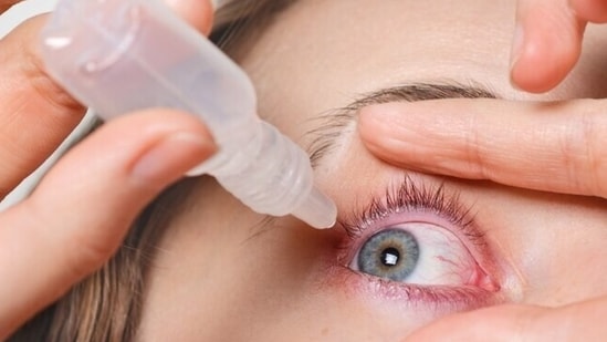 Exposure to environmental pollutants such as carbon monoxide, nitrogen dioxide and dust particles are making people prone to red, watery eyes and various eye allergies. (Freepik)
