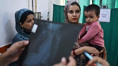 In this picture taken on November 7, a doctor (out of frame) examines the X-ray of a child with breathing difficulties at the emergency ward of the government-run Chacha Nehru Bal Chikitsalaya children hospital in New Delhi. (AFP)